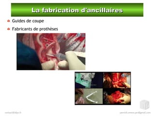 La fabrication d'ancillairesLa fabrication d'ancillaires
Guides de coupe
Fabricants de prothèses
 