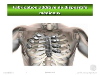 Décembre 20151
Fabrication additive de dispositifsFabrication additive de dispositifs
médicauxmédicaux
 