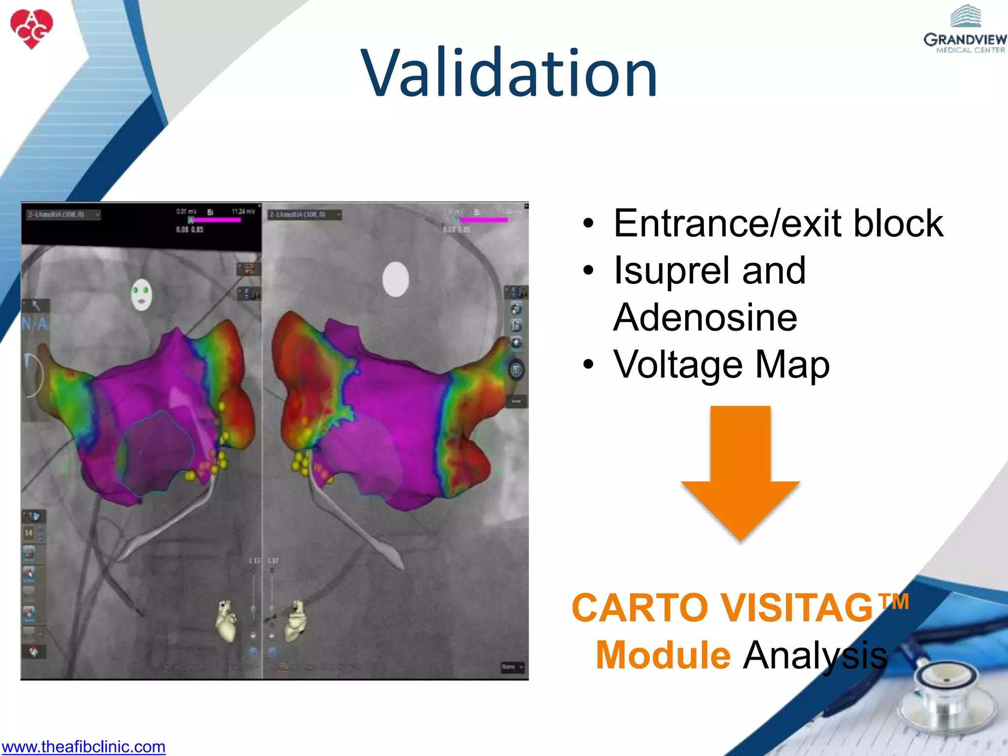 • Entrance/exit block
• Isuprel and
Adenosine
• Voltage Map
Validation
CARTO VISITAG™
Module Analysis
www.theafibclinic.com
 