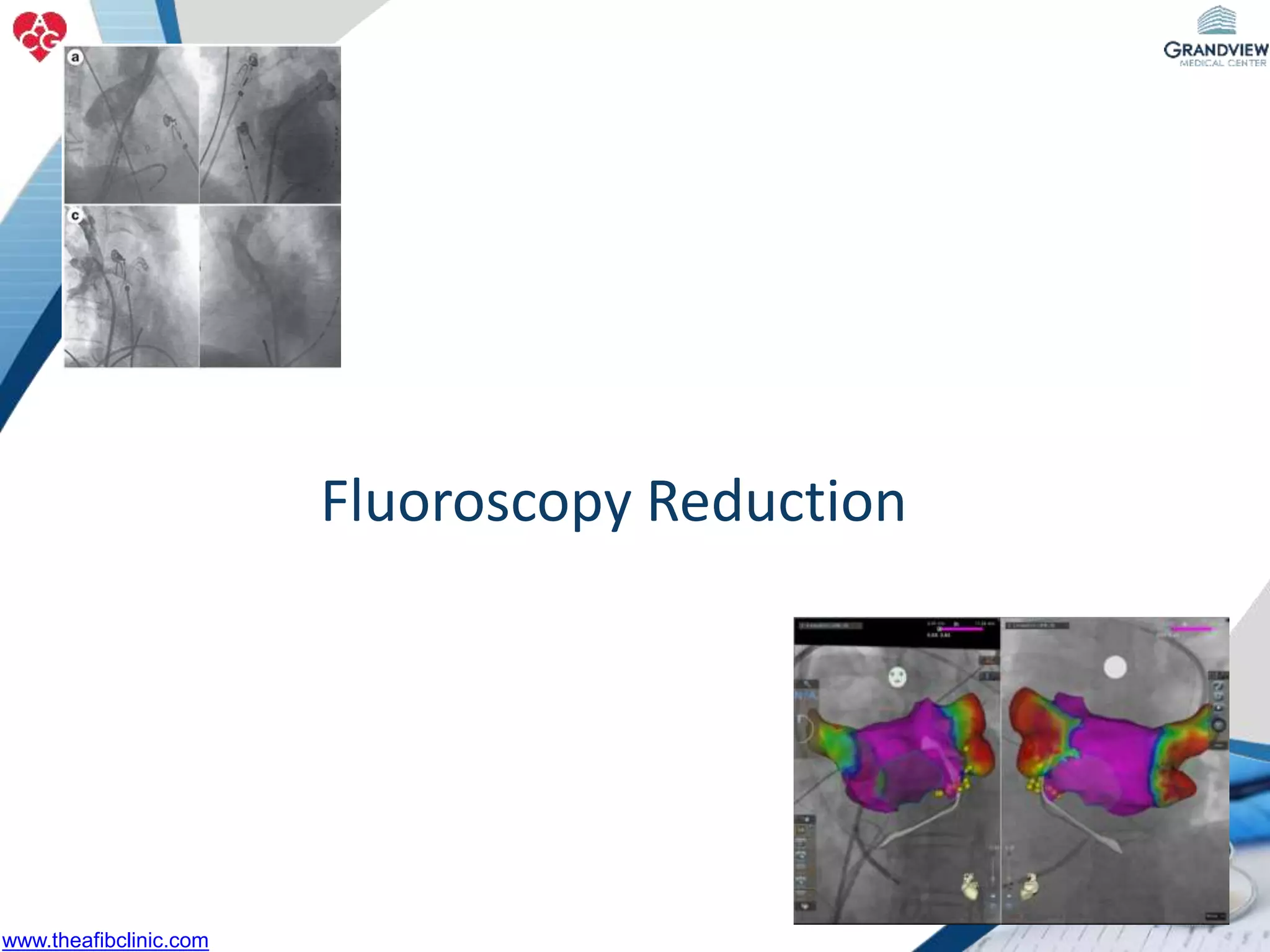 Fluoroscopy Reduction
www.theafibclinic.com
 