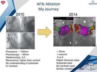 The Evolution of Atrial Fibrillation Ablation: Utilizing Current ...