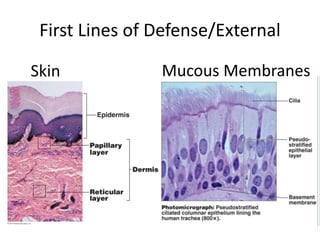 First Lines of Defense/External
Skin Mucous Membranes
 