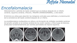 Asfixia Neonatal
Ablandamiento o pérdida de tejido cerebral que se produce después de un infarto
cerebral; isquemia cerebral, infección, TRAUMA CRANEOCEREBRAL, u otra lesión.
El término se utiliza para describir los márgenes corticales poco definidos y la disminución
de la consistencia del tejido cerebral después de un infarto.
La encefalomalacia multiquística se refiere a la formación de múltiples cavidades quísticas
de tamaño variable en la corteza cerebral de los recién nacidos y niños luego de lesiones,
producidas fundamentalmente por eventos perinatales de hipoxia-isquemia.
Encefalomalacia
 