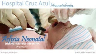 Asfixia Neonatal
Hospital Cruz Azul
Erickmar Morales-Medrano.
(Pre Interno)
Neonatología.
Managua, Nicaragua Martes,19 de Mayo 2015
 