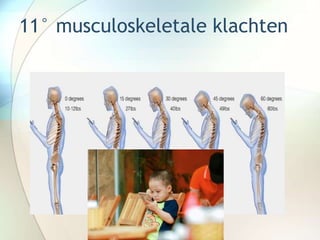 11° musculoskeletale klachten
 