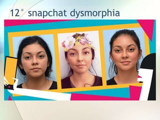 12° snapchat dysmorphia
 
