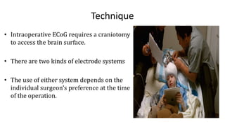 Technique
• Intraoperative ECoG requires a craniotomy
to access the brain surface.
• There are two kinds of electrode systems
• The use of either system depends on the
individual surgeon’s preference at the time
of the operation.
 