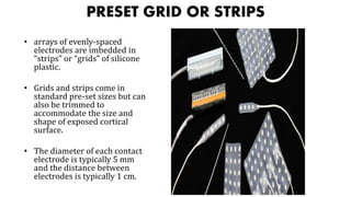 PRESET GRID OR STRIPS
• arrays of evenly-spaced
electrodes are imbedded in
“strips” or “grids” of silicone
plastic.
• Grids and strips come in
standard pre-set sizes but can
also be trimmed to
accommodate the size and
shape of exposed cortical
surface.
• The diameter of each contact
electrode is typically 5 mm
and the distance between
electrodes is typically 1 cm.
 