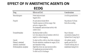 EFFECT OF IV ANESTHETIC AGENTS ON
ECOG
 
