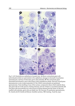 Aflatoxins – Biochemistry and Molecular Biology 
182 
Fig. 2. A-D. Seminiferous epithelium of treated mice. A: Shows uninucleate giant cells 
(arrowheads) (which are spermatids) in the epithelium, damage to chromatin of pachytene 
spermatocytes, and loss of intercalary germ cells (asterisks). B: The uninucleate giant 
spermatid (arrowhead) is seen in the lumen of the seminiferous tubule. Necrosis of pachytene 
spermatocytes is also evident (asterisks). C: The UNGCs (arrowheads) are pachytene 
spermatocytes. Note doubling of size of the nucleus, compared to those which underlie them. 
The giant cells are in the process of being released, and one of them is vacuolated (asterisk). D: 
The giant cells (arrowheads) are in the process of being released into the lumen. In the area 
marked with asterisks, germ cells are totally lost. NE, necrosis; PS, pachytene spermatocytes; 
SC, Sertoli cell; SF, Sertoli cell fibrosis. Semithin sections, TBO staining. Scale bar, 4μm. 
 