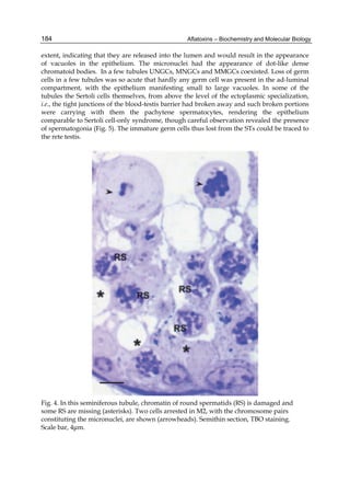 184 
extent, indicating that they are released into the lumen and would result in the appearance 
of vacuoles in the epithelium. The micronuclei had the appearance of dot-like dense 
chromatoid bodies. In a few tubules UNGCs, MNGCs and MMGCs coexisted. Loss of germ 
cells in a few tubules was so acute that hardly any germ cell was present in the ad-luminal 
compartment, with the epithelium manifesting small to large vacuoles. In some of the 
tubules the Sertoli cells themselves, from above the level of the ectoplasmic specialization, 
i.e., the tight junctions of the blood-testis barrier had broken away and such broken portions 
were carrying with them the pachytene spermatocytes, rendering the epithelium 
comparable to Sertoli cell-only syndrome, though careful observation revealed the presence 
of spermatogonia (Fig. 5). The immature germ cells thus lost from the STs could be traced to 
the rete testis. 
Aflatoxins – Biochemistry and Molecular Biology 
Fig. 4. In this seminiferous tubule, chromatin of round spermatids (RS) is damaged and 
some RS are missing (asterisks). Two cells arrested in M2, with the chromosome pairs 
constituting the micronuclei, are shown (arrowheads). Semithin section, TBO staining. 
Scale bar, 4μm. 
 