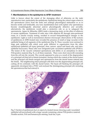 A Comprehensive Review of Male Reproductive Toxic Effects of Aflatoxin 
189 
7. Manifestations in the epididymis to AFB1 treatment 
Little is known about the extent of the damaging effect of aflatoxins on the male 
reproductive tract, particularly the epididymis. Epididymis being the critical organ where in 
the spermatozoa arrive from the testis and undergo physiological maturation so as to 
become motile and fertilizable, any toxic manifestation here will explain why spermatozoa 
become morphologically abnormal and/or physiologically defective and unviable; 
alternatively, the epididymis would play a protective role so as to safeguard the 
spermatozoa. Agnes & Akbarsha, (2001) made a pioneering study on the effect of aflatoxin 
in mouse epididymis. Treatment of male mice with aflatoxin B1 through intra-peritoneal 
route, in a chronic toxicity testing, resulted in several histopathological changes in the 
epididymis. Light as well as transmission electron microscopic observations of the sections 
of epididymis of AFB1-treated mice revealed the presence of small or large vacuoles in the 
epithelial lining of all segments of the epididymis (Fig. 9). These vacuoles were enclosed in 
large pale epithelial cells which were quite different in organization from the other 
epididymal epithelial cell types (principal, clear, narrow, apical and basal cells, and intra-epithelial 
leucocytes). These cells were designated pale vacuolated epithelial cells (PVECs). 
The lumen of the vacuole contained spermatozoa and debris or an amorphous to dense 
PAS-positive material (Fig. 9), or all three materials. There were short microvilli extending 
from the cell into the vacuole. The vacuole appeared to arise as a result of the degeneration 
of a principal cell that led to fistula formation, during which the content of the ductal lumen 
and the principal cell fistula merged and spermatozoa from the ductal lumen entered into 
the fistula. The neighbouring intact principal cells bent over the degenerating principal cell, 
cutting off its continuity with the ductal lumen. The basal cell flanking the principal cell 
apparently developed into a PVEC and enclosed the disintegrating principal cell, including 
the spermatozoa that had entered it. 
Fig. 9. Section of epididymal duct at caput of a treated mouse showing a pale vacuolated 
epithelial cell (arrowhead) with a large vacuole containing a dense PAS positive material. 
Paraffin section, PAS and hematoxylin staining. Scale bar, 4 μm. 
 