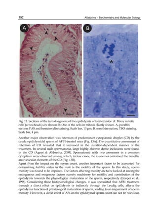 Aflatoxins – Biochemistry and Molecular Biology 
192 
Fig. 12. Sections of the initial segment of the epididymis of treated mice. A: Many mitotic 
cells (arrowheads) are shown. B: One of the cells in mitosis clearly shown. A, paraffin 
section, PAS and hematoxylin staining. Scale bar, 10 μm; B, semithin section, TBO staining. 
Scale bar, 4 μm. 
Another major observation was retention of predominant cytoplasmic droplet (CD) by the 
cauda epididymidal sperm of AFB1-treated mice (Fig. 13A). The quantitative assessment of 
retention of CD revealed that it increased in the duration-dependent manner of the 
treatment. In several such spermatozoa, large highly electron dense inclusions were found 
in the CD (Agnes & Akbarsha, 2003). Spermatozoa with two axonemes in a common 
cytoplasm were observed among which, in few cases, the axonemes contained the lamellar 
and vesicular elements of the CD (Fig. 13B). 
Apart from the impact on the sperm count, another important factor to be accounted for 
determining fertility status in the male is the motility of the sperm. In this study, sperm 
motility was found to be impaired. The factors affecting motility are to be looked at among the 
endogenous and exogenous factors namely machinery for motility and contribution of the 
epididymis towards the physiological maturation of the sperm, respectively (Cooper et al., 
1998). Considering these histopathological changes, it was speculated that AFB1 treatment 
through a direct effect on epididymis or indirectly through the Leydig cells, affects the 
epididymal function of physiological maturation of sperm, leading to an impairment of sperm 
motility. However, a direct effect of AFs on the epididymal sperm count can not be ruled out, 
 