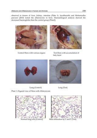 Aflatoxins and Aflatoxicosis in Human and Animals 
239 
observed in tissues of liver, kidney, intestine (Plate 1). Jayabharathi and Mohamudha 
parveen (2010) tested the aflatoxicosis in hens. Haematological analysis showed the 
decreased haemoglobin than the control group (Plate2). 
Control Hens with various organs Test Hens with accumulation of 
fatty layer 
Lung (Control) Lung (Test) 
Plate 1. Organal view of Hens with Aflatoxicosis 
Normal lung cells (Control) Mild infiltration by L and P (Test) 
 