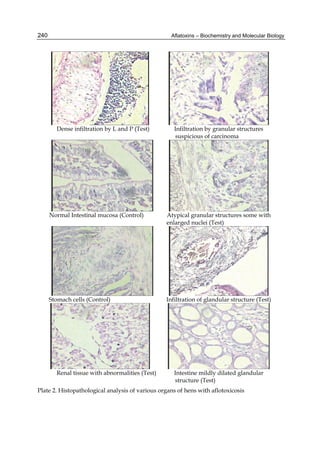 Aflatoxins – Biochemistry and Molecular Biology 
240 
Dense infiltration by L and P (Test) Infiltration by granular structures 
suspicious of carcinoma 
Normal Intestinal mucosa (Control) Atypical granular structures some with 
enlarged nuclei (Test) 
Stomach cells (Control) Infiltration of glandular structure (Test) 
Renal tissue with abnormalities (Test) Intestine mildly dilated glandular 
structure (Test) 
Plate 2. Histopathological analysis of various organs of hens with aflotoxicosis 
 