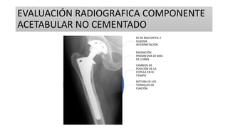 AFLOJAMIENTO PROTESICO CADERA.pptx