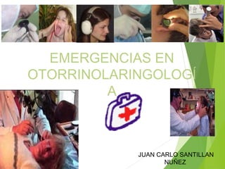 EMERGENCIAS EN 
OTORRINOLARINGOLOGÍ 
A 
JUAN CARLO SANTILLAN 
NUÑEZ 
 