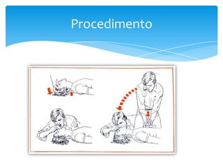 Procedimento

 