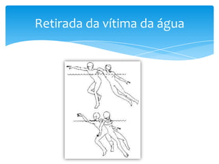 Retirada da vítima da água

 