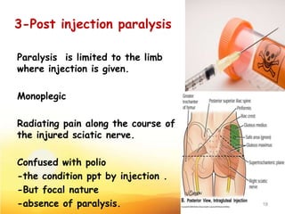 3-Post injection paralysis
Paralysis is limited to the limb
where injection is given.
Monoplegic
Radiating pain along the course of
the injured sciatic nerve.
Confused with polio
-the condition ppt by injection .
-But focal nature
-absence of paralysis. 18
 