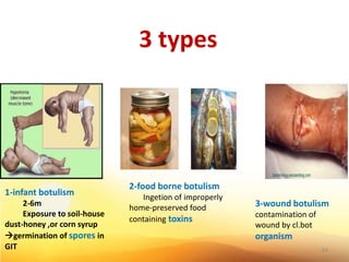 3 types
1-infant botulism
2-6m
Exposure to soil-house
dust-honey ,or corn syrup
germination of spores in
GIT
2-food borne botulism
Ingetion of improperly
home-preserved food
containing toxins
3-wound botulism
contamination of
wound by cl.bot
organism
34
 
