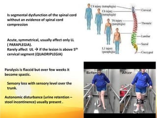 Is segmental dysfunction of the spinal cord
without an evidence of spinal cord
compression
Acute, symmetrical, usually affect only LL
( PARAPLEGIA).
Rarely affect UL  if the lesion is above 5th
cervical segment (QUADRIPLEGIA)
Paralysis is flaccid but over few weeks it
become spastic.
Sensory loss with sensory level over the
trunk.
Autonomic disturbance (urine retention –
stool incontinence) usually present .
40
 