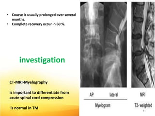 • Course is usually prolonged over several
months.
• Complete recovery occur in 60 %.
CT-MRI-Myelography
is important to differentiate from
acute spinal cord compression
is normal in TM
41
investigation
 