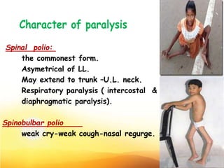 Spinal polio:
the commonest form.
Asymetrical of LL.
May extend to trunk –U.L. neck.
Respiratory paralysis ( intercostal &
diaphragmatic paralysis).
Spinobulbar polio
weak cry-weak cough-nasal regurge.
10
 