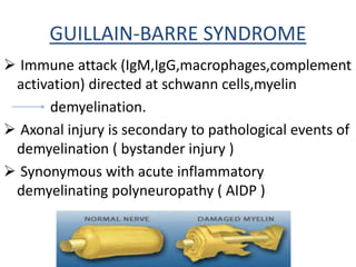 GUILLAIN-BARRE SYNDROME
 Immune attack (IgM,IgG,macrophages,complement
activation) directed at schwann cells,myelin
demyelination.
 Axonal injury is secondary to pathological events of
demyelination ( bystander injury )
 Synonymous with acute inflammatory
demyelinating polyneuropathy ( AIDP )
 