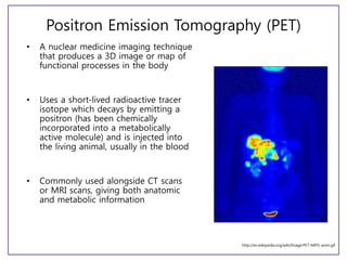 Positron Emission Tomography (PET)
• A nuclear medicine imaging technique
that produces a 3D image or map of
functional processes in the body
• Uses a short-lived radioactive tracer
isotope which decays by emitting a
positron (has been chemically
incorporated into a metabolically
active molecule) and is injected into
the living animal, usually in the blood
• Commonly used alongside CT scans
or MRI scans, giving both anatomic
and metabolic information
http://en.wikipedia.org/wiki/Image:PET-MIPS-anim.gif
 