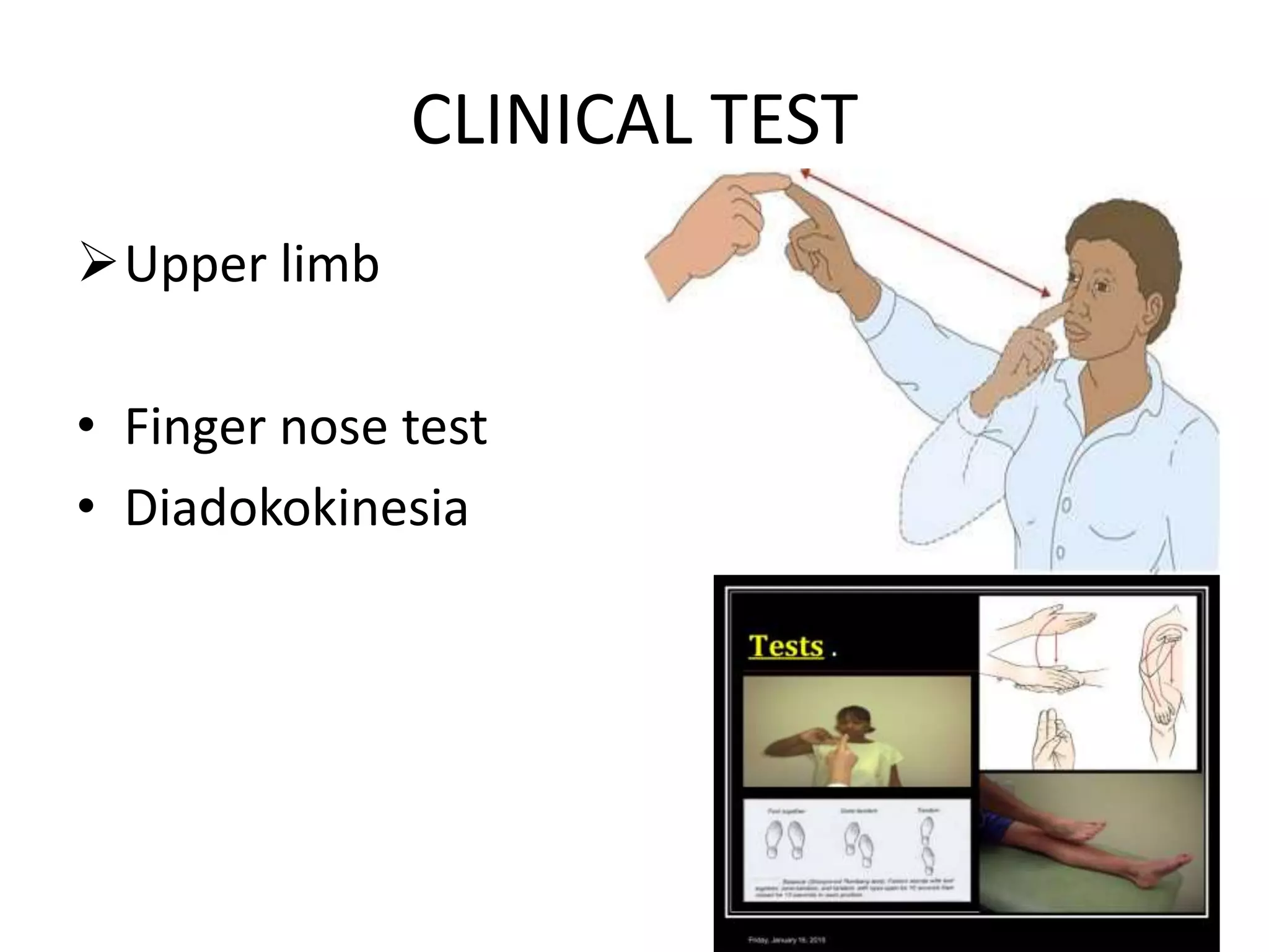 cerebellar dysfunction-ppt | PPTX