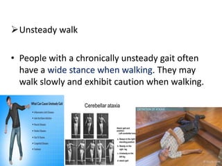 Unsteady walk
• People with a chronically unsteady gait often
have a wide stance when walking. They may
walk slowly and exhibit caution when walking.
 