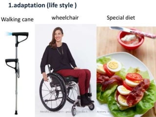 cerebellar dysfunction-ppt