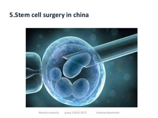 cerebellar dysfunction-ppt