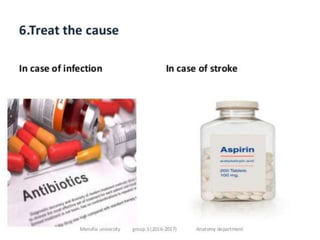cerebellar dysfunction-ppt