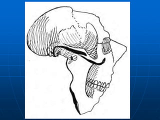 Formato GeométricoO Continente Africano tem o formato de um crânio humano com o nariz na SomáliaFuga de Cérebros