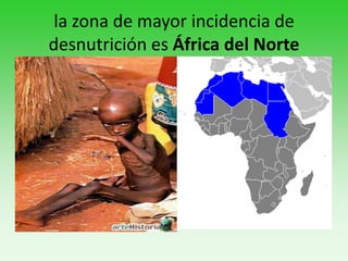 la zona de mayor incidencia de
desnutrición es África del Norte
 