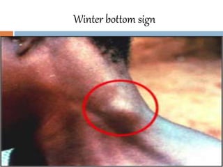 Winterbutton Sign African trypanosoma | PPTX