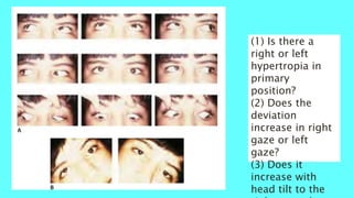 Paediatric Neuro-Ophthalmology | PPTX
