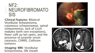 Nf2 Child Paediatric Neuro-Ophthalmology | PPTX