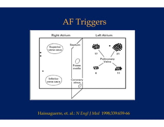 AF Tr
                 riggers




Haissaguerre, et. al.: N E
                         Engl J Med 1998;339:659-66
 