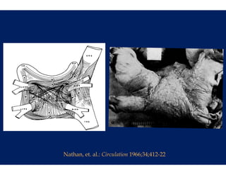 Nathan, et. al.: Circulation 1966;34;412-22
                     u
 