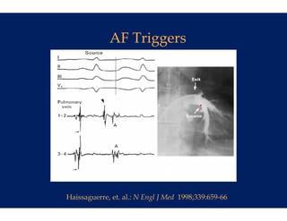 AF Tr
                 riggers




Haissaguerre, et. al.: N E
                         Engl J Med 1998;339:659-66
 