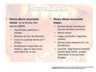 • Úlcera aftosa recurrente
menor: es la forma más
común (80%)
• Superficiales, dolorosas y
aisladas.
• Menores de 1cm. De diámetro.
• Curan sin cicatrizar dentro de 7-
10 días.
• Periodicidad: meses libres de
úlceras y algunos que nunca
están libres de úlceras.
• Úlcera aftosa recurrente
mayor:
• Nombre formal: Periadenitis
mucosa necrótica recurrente.
• Menos común
• Largas, profundas, irregulares,
(unidas)
• Úlceras ovales Mayores de 1 cm.
De diámetro.
• Curación: llega hasta 6 semanas,
pueden dejar cicatriz, pueden
distorsionar la mucosa oral-
faringea.
 