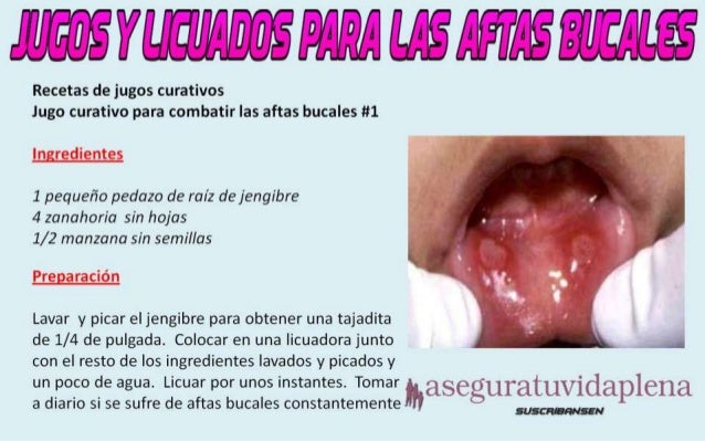 La medicina contra el hongo sobre las uñas