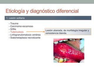 Etiología y diagnóstico diferencial
- Trauma
- Carcinoma escamoso
- Sífilis
- Tuberculosis
- Linfogranulomatosis venérea
- Sialometaplasia necrotizante
1. Lesión solitaria
Lesión ulcerada, de morfología irregular y
consistencia blanda.
 