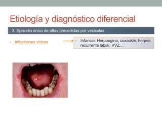 Etiología y diagnóstico diferencial
-  Infecciones víricas
3. Episodio único de aftas precedidas por vesículas
-  Infancia: Herpangina, coxackie, herpes
recurrente labial, VVZ…
 