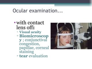 Ocular examination...
•with contact
lens off:
▫ Visual acuity
▫ Biomicroscop
y ; conjunctival
congestion,
papillae, corneal
staining
▫ tear evaluation
13
 