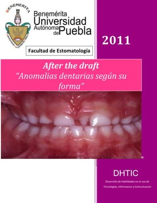 2011
   Facultad de Estomatología

      After the draft
“Anomalias dentarias según su
           forma”




                                     Amber López Palacios



                                      DHTIC
                                Desarrollo de Habilidades en el uso de
                               Tecnologias, Informacion y Comunicacion
 
