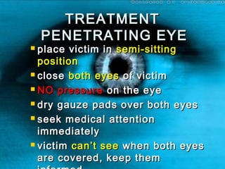 TREATMENTTREATMENT
PENETRATING EYEPENETRATING EYE
 place victim inplace victim in semi-sittingsemi-sitting
positionposition
 closeclose both eyesboth eyes of victimof victim
 NO pressureNO pressure on the eyeon the eye
 dry gauze pads over both eyesdry gauze pads over both eyes
 seek medical attentionseek medical attention
immediatelyimmediately
 victimvictim can’t seecan’t see when both eyeswhen both eyes
are covered, keep themare covered, keep them
 
